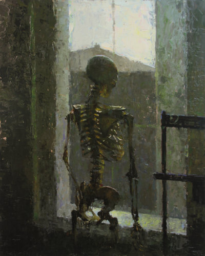 Patient Bones
